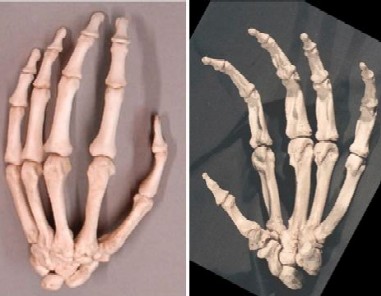 The Hand of Unknown Origin